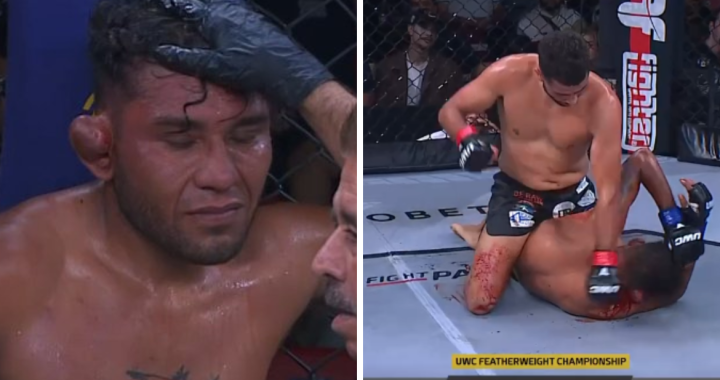 José Peñaloza, cauliflower ear