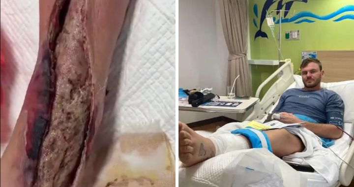 Tim Schultz, staph infection