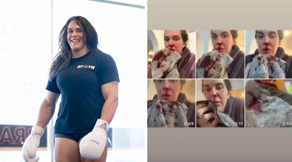 Gabi Garcia, Gabi Garcia domestic abuse