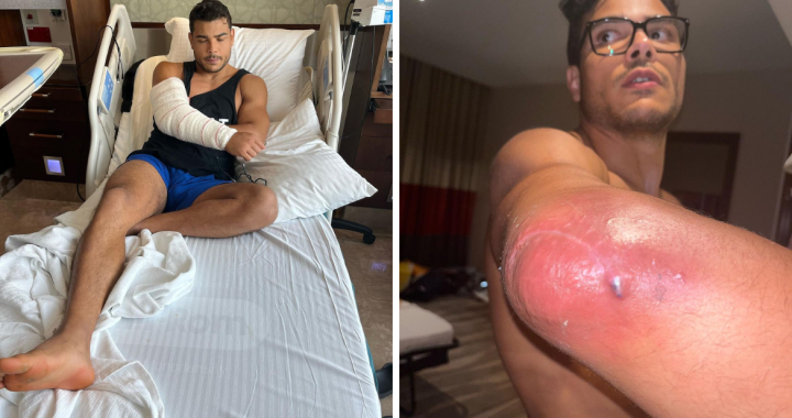 Paulo Costa, elbow surgery, UFC 294