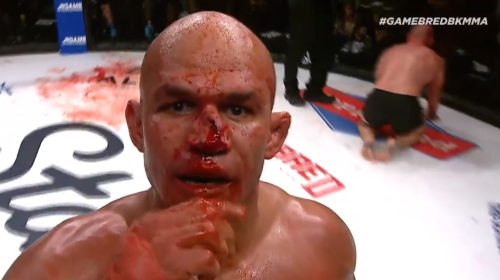 Junior Dos Santos