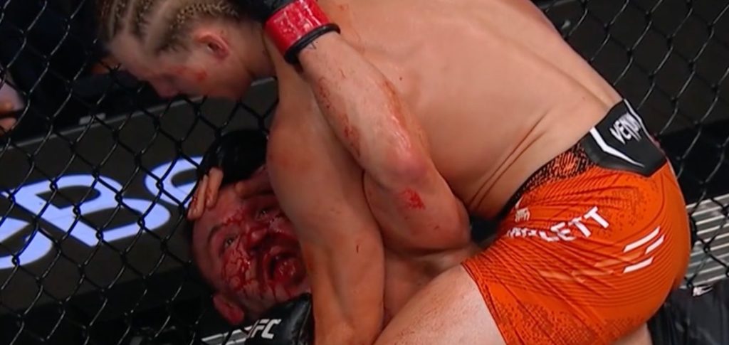 Paddy Pimblett, UFC 314