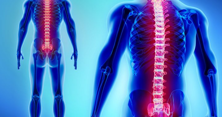 Paralysis Injury