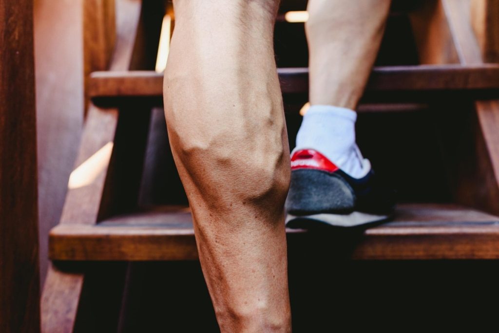 Varicose Veins, mma fighters