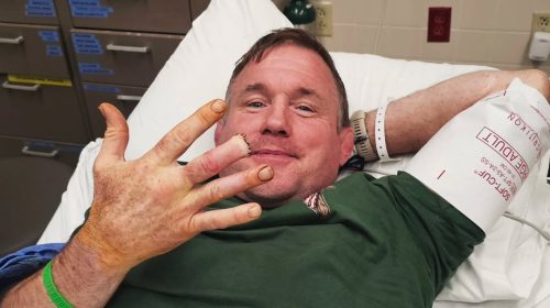 Matt Hughes, hospital